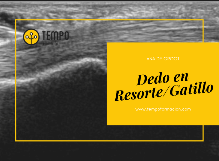 dedo-en-resorte-gatillo-ecografia-con-ana-de-groot